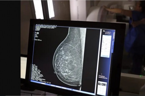 Câncer de Mama: Diagnóstico Precoce amplia chance de Cura
